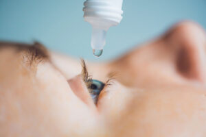 A woman's eye being treated with an eye drop. Get quality eye care products from Optics Suppliers Pennsylvania.